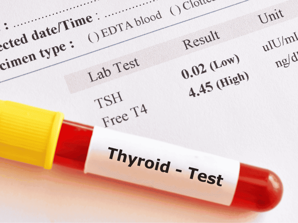 thyroide test sanguin
